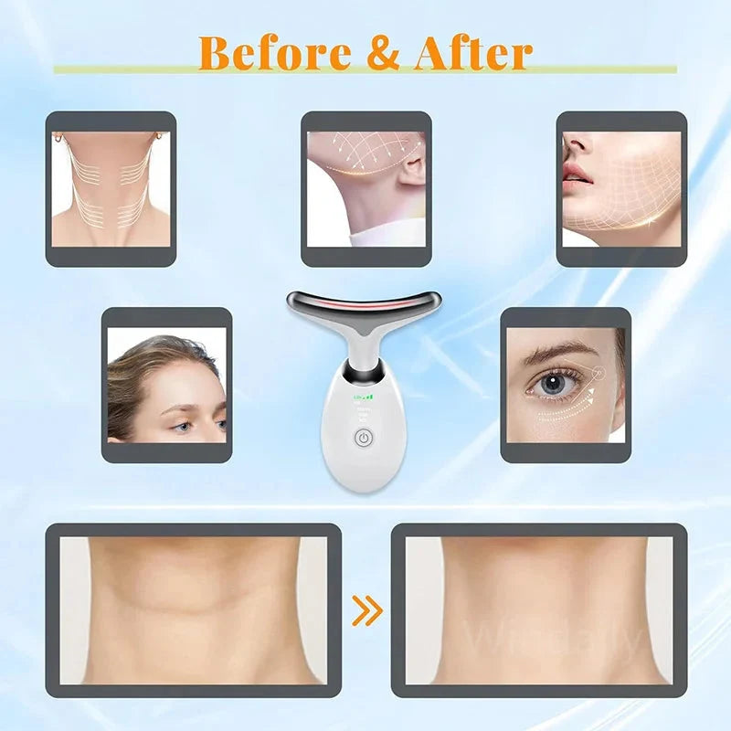 Anti Wrinkle Facial Massager Beauty Device Skin (Colors)